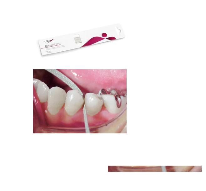 Tira Lija Acero Diamantada Medio 2.5mm Tdv Stripping Dental