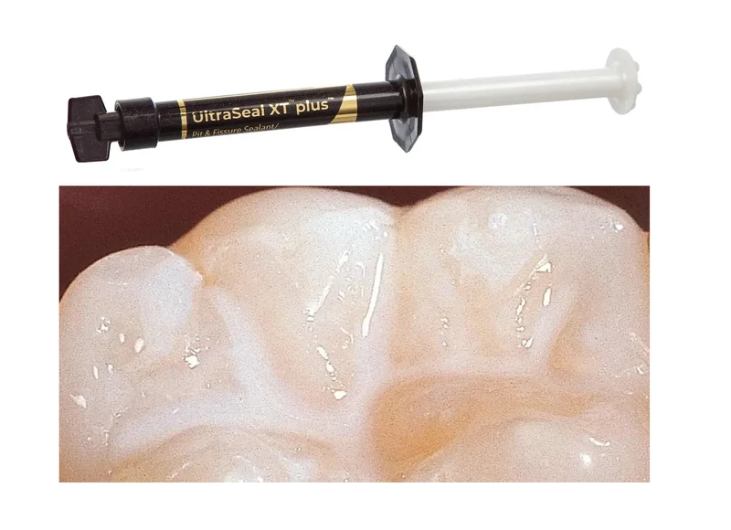 ULTRASEAL XT PLUS SELLADOR DE FOSETAS Y FISURAS